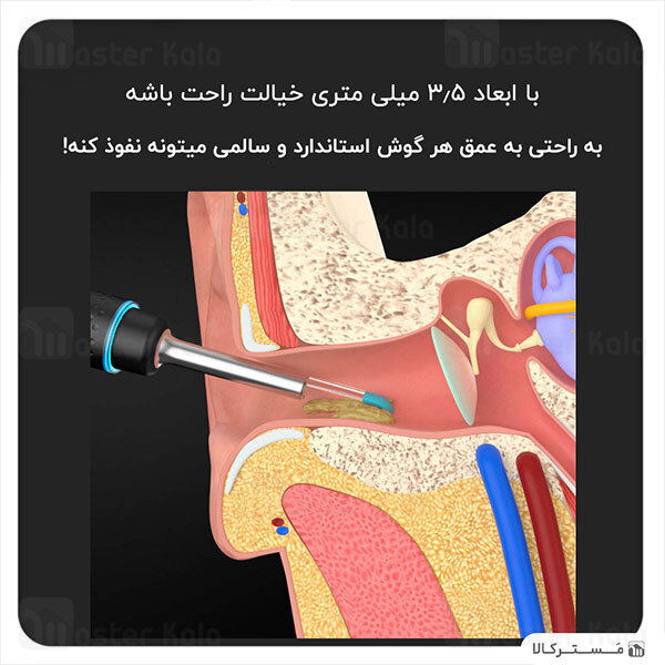 گوش پاک کن هوشمند Xiaomi Bebird M9 Pro Intelligent Visual Ear Cleaner